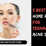 5 Best Super Effective Home Remedies for Teenage Acne Scars