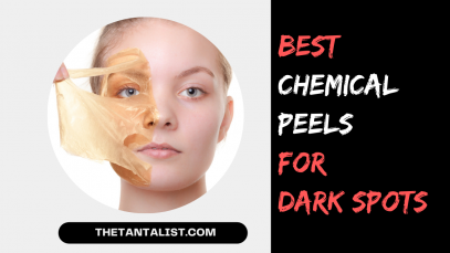 Best Chemical Peels for Dark Spots