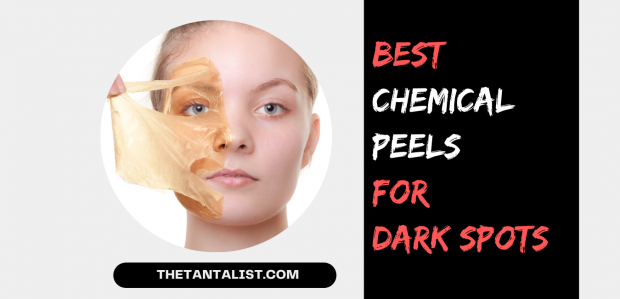 Best Chemical Peels for Dark Spots